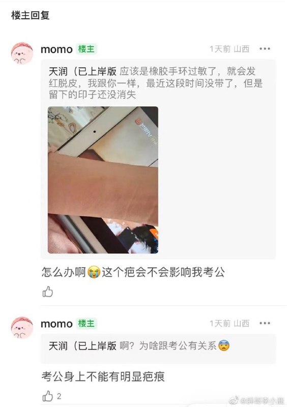 戴手环过敏恐影响考公By