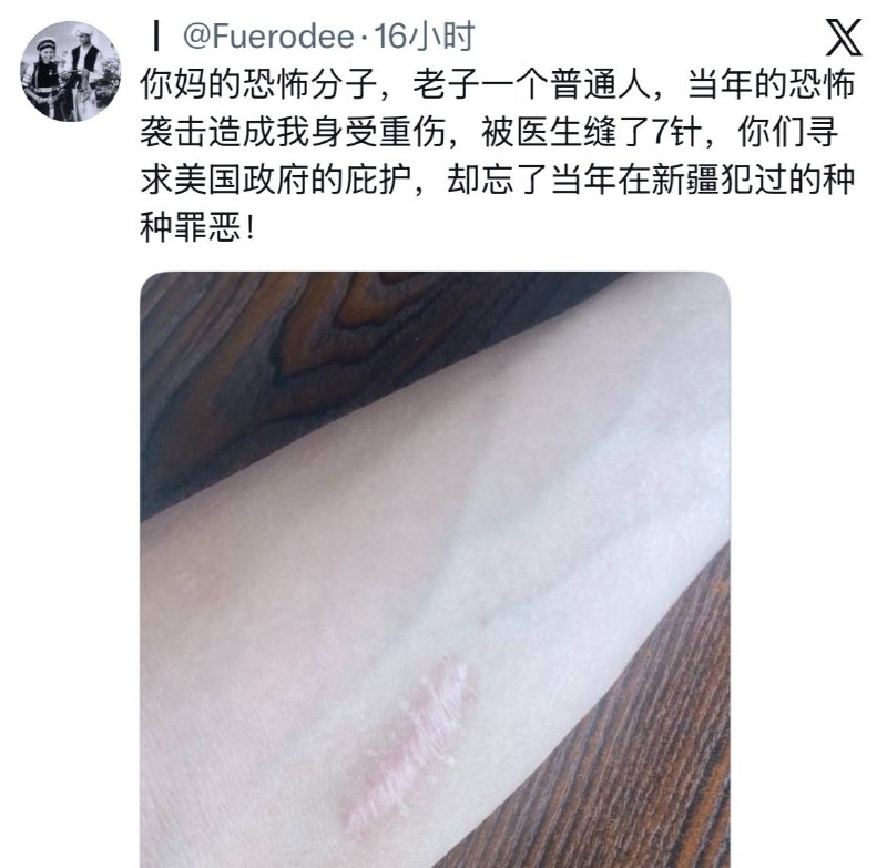 胳膊挺白的，来当小受